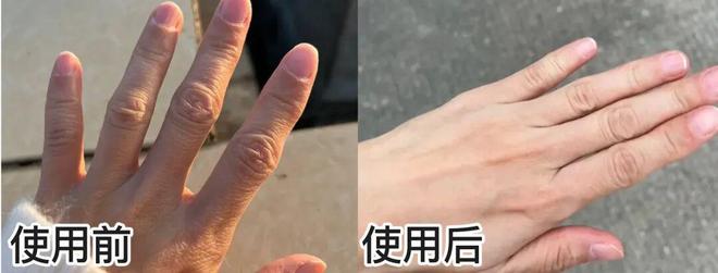 ！后来发现是小丑竟然是我的手开元棋牌一直以为是首饰太丑(图2)